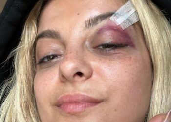 Incident na nastupu američke pjevačice: Nakon što je pogođena telefonom u glavu, Bebe Rexha se zateturala i pala na koljena (VIDEO)