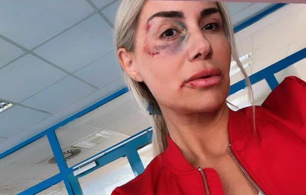 Selma Bajrami u modricama, završila u bolnici Selma Bajrami u modricama, završila u bolnici